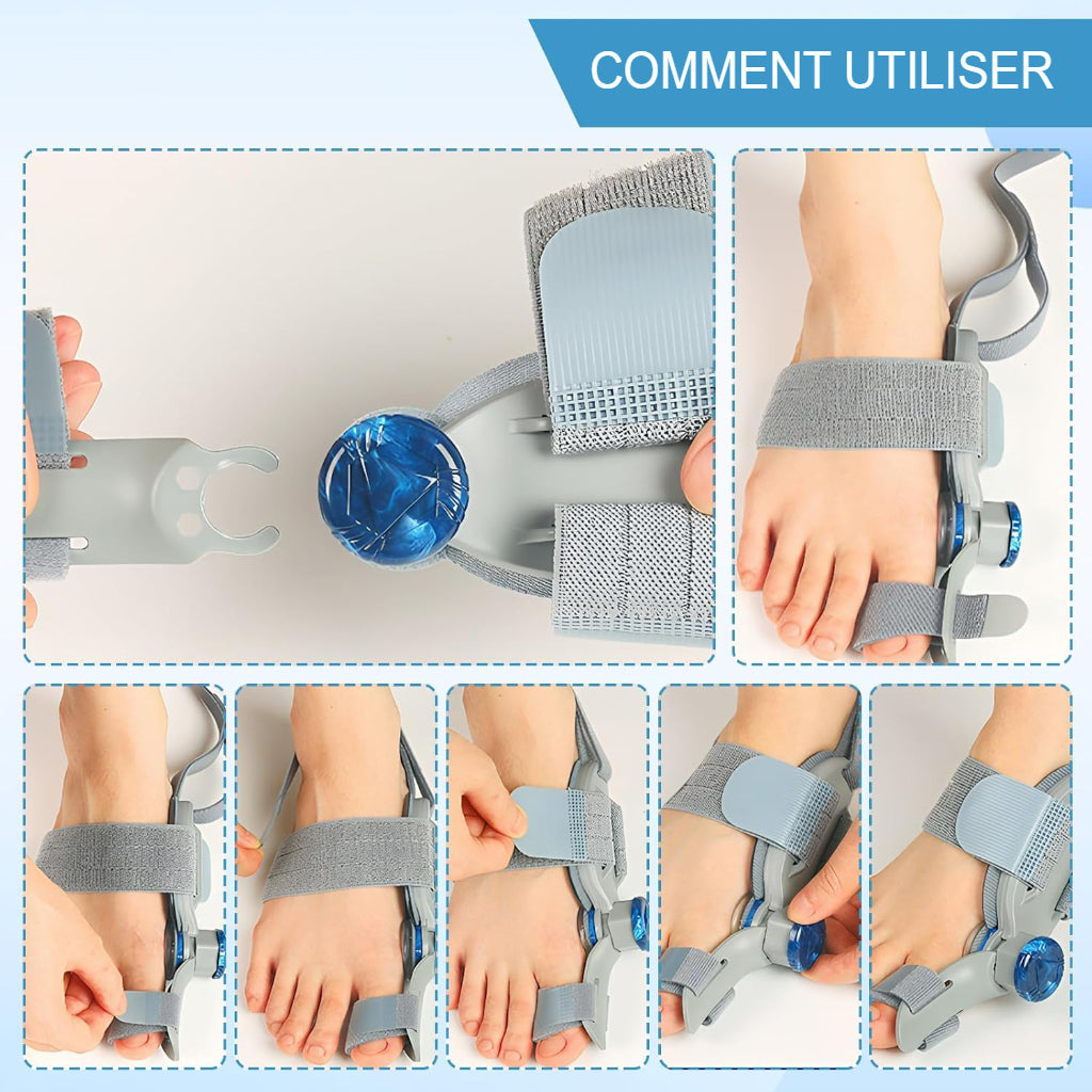 Correcteur Orthopédique Hallux Valgus Ajustable – Soulagement & Alignement Instantané