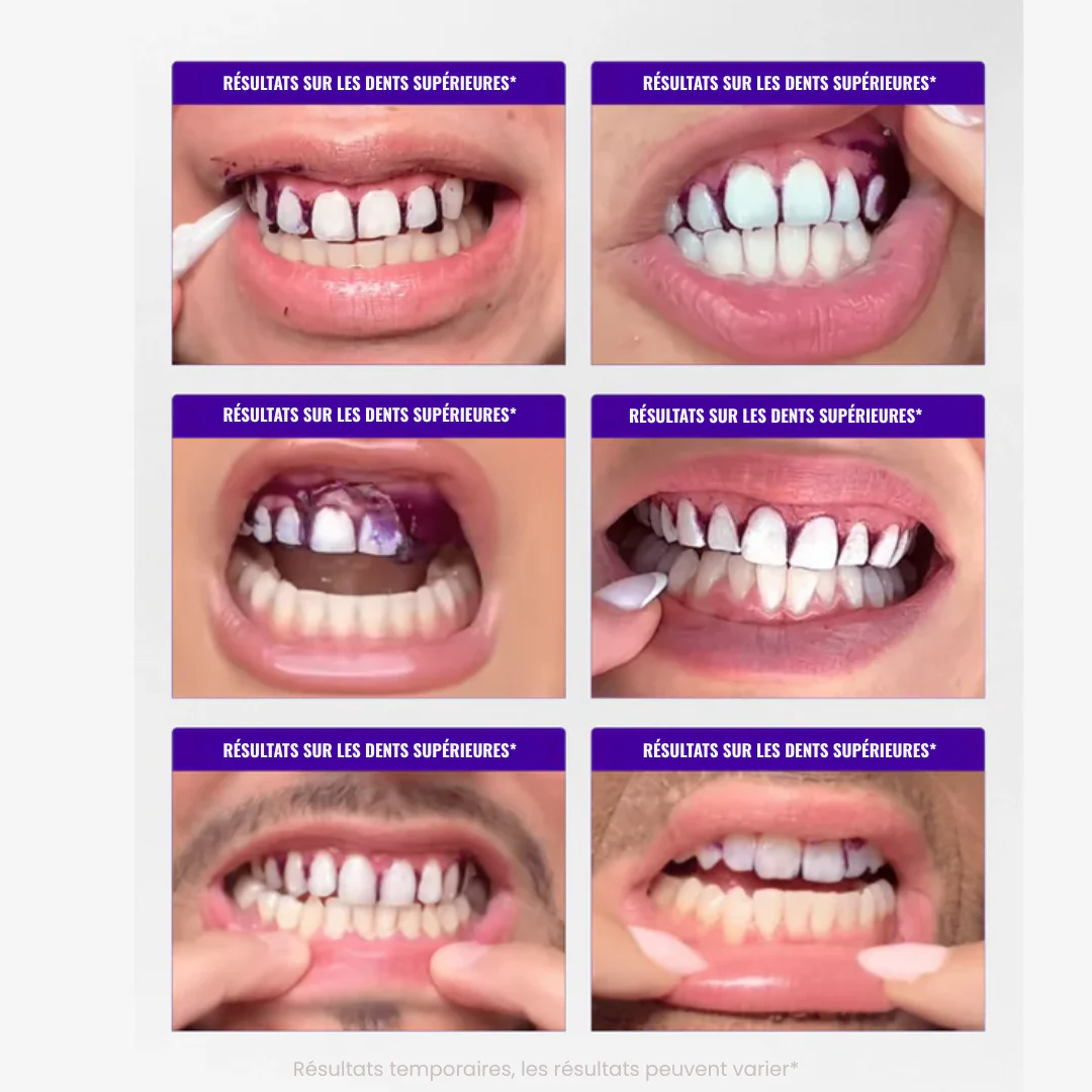 Bandes Blanchissantes Violettes V34 – Sourire Blanc Instantané en 30 Minutes